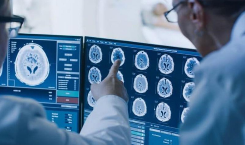Advancing Diagnostics with X-Ray and Radiology Technology